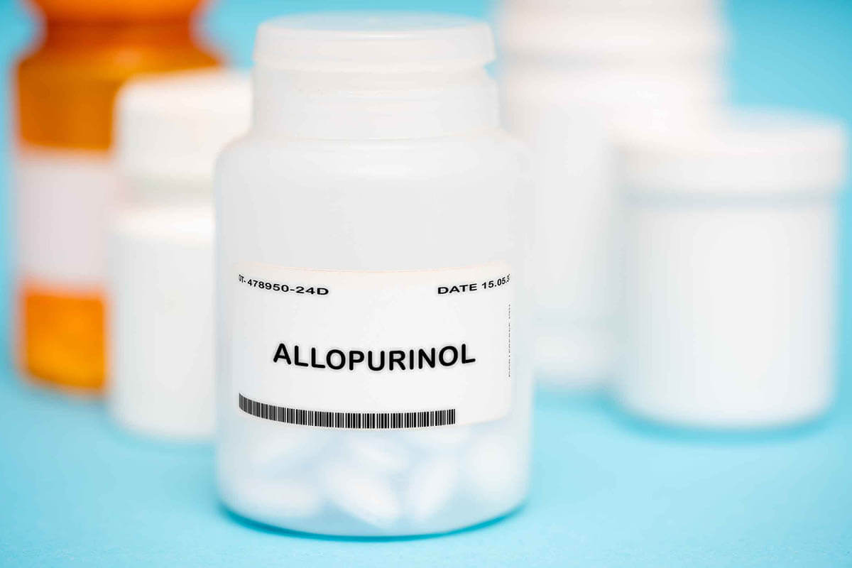 Allopurinol